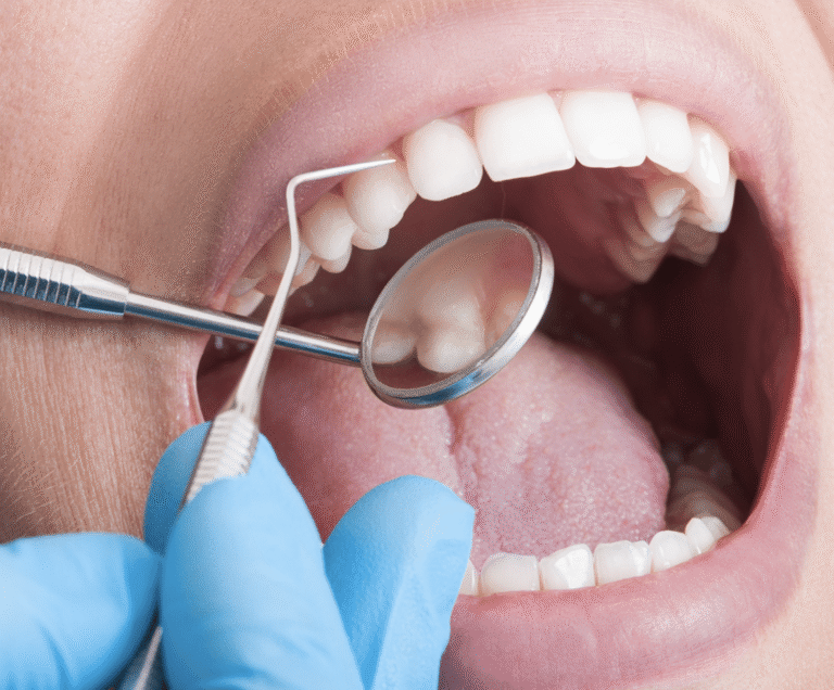 Dentist performing a dental exam on a patient in Grayson